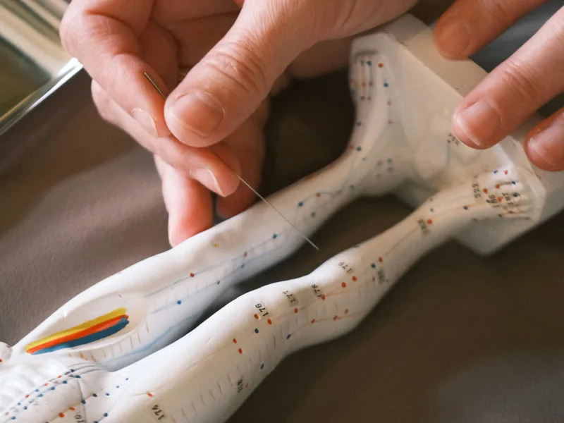 Acupuncture at Top Spine Chiropractic in Worcester