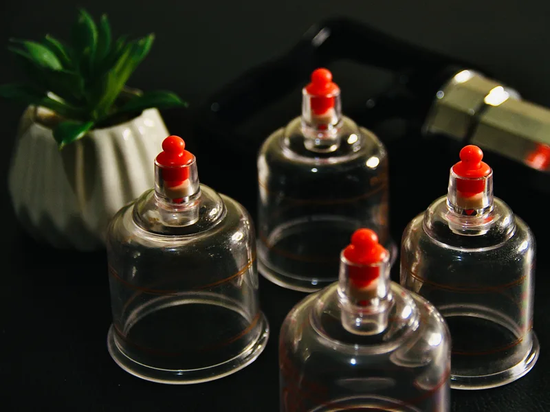How Cupping Therapy works at Top Spine Chiropractic