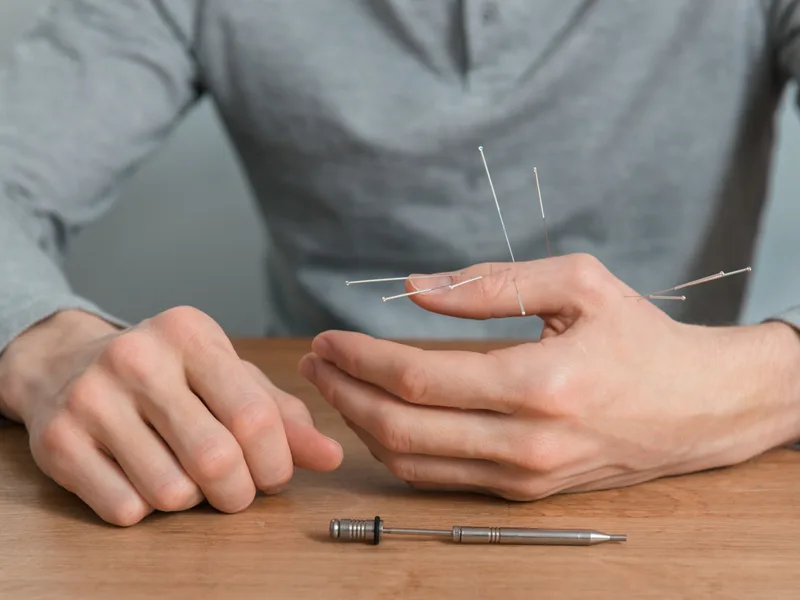 Dry Needling at Top Spine Chiropractic in Worcester