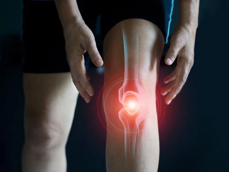 How Top Spine Chiropractic treats arthritis in Worcester